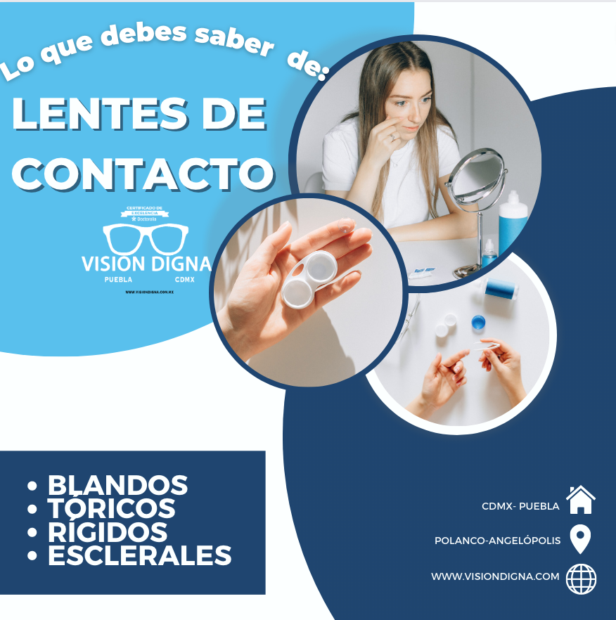 Lo que debes saber de lentes de contacto Vision Digna